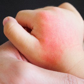 dermatologo pediatra ambato medical platinum